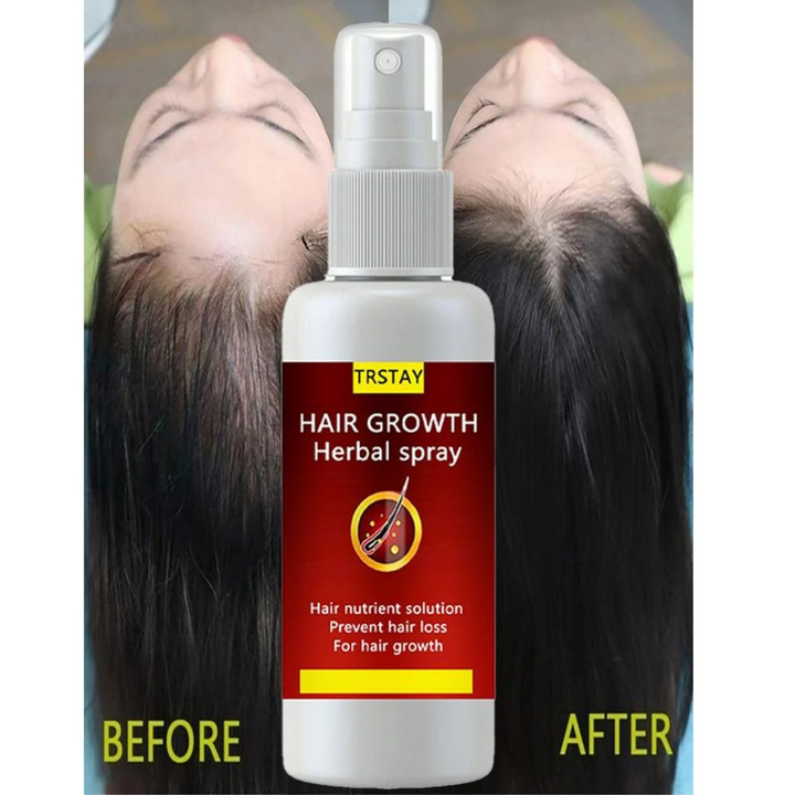 Soro de Crescimento de Cabelo Anti Queda Spray Rápido - HAIR GROWTH - COMPRE 1 LEVE 3 PROMOÇÃO