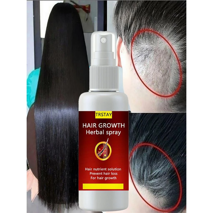 Soro de Crescimento de Cabelo Anti Queda Spray Rápido - HAIR GROWTH - COMPRE 1 LEVE 3 PROMOÇÃO